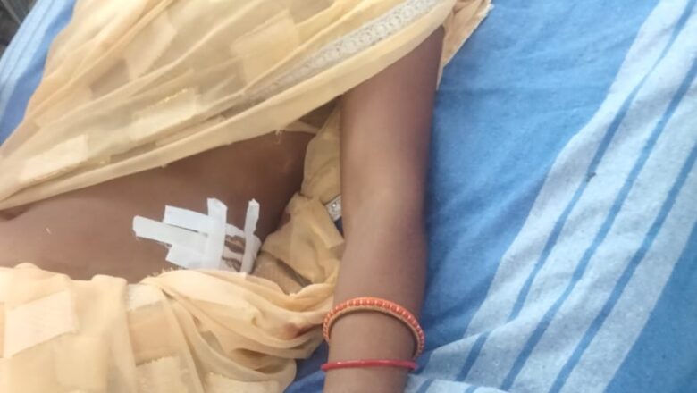 जंगली सूअर के हमले में महिला मजदूर गंभीर रूप से घायल, मुआवजा की मांग