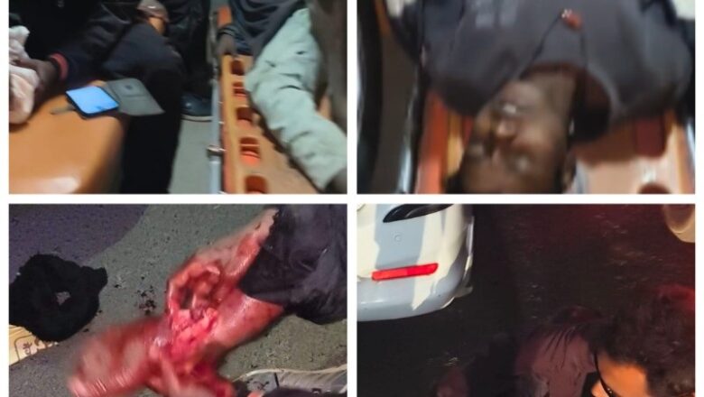 उमरिया में सड़क हादसे में बाइक सवार 4 युवक घायल, गंभीर हालत में जबलपुर रेफर