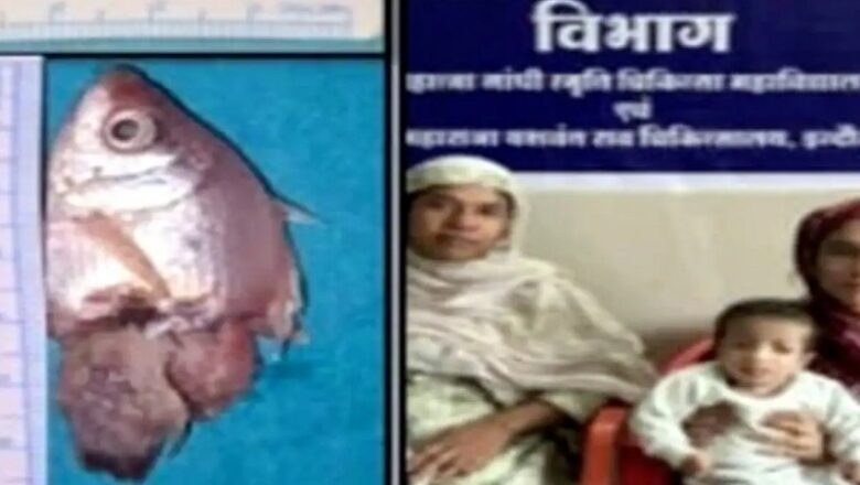 MP: इंदौर में MYH के डॉक्टरों का कमाल….1 साल के बच्चे के गले में फंसी जिंदा मछली, सर्जरी कर बचाई जान