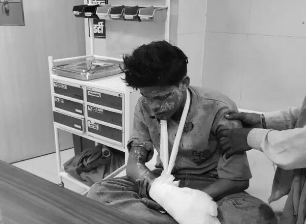रायसेन में गज कुंडी में बारूद भरते समय विस्फोट, दो किशोर जलकर अस्पताल में भर्ती