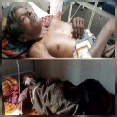 कोंडागांव में बस्तर बुडरा गांव में तेंदू के हमले से पाँच परिवार के सदस्य घायल